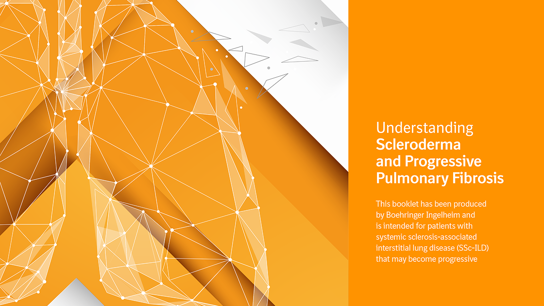 Understanding SSc-ILD thumbnail